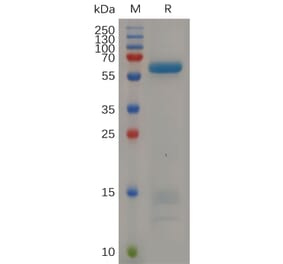 SDS-PAGE - Recombinant Human IGFBP7 Protein (Fc Tag) (A318055) - Antibodies.com