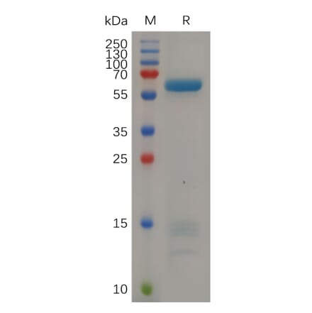 SDS-PAGE - Recombinant Human IGFBP7 Protein (Fc Tag) (A318055) - Antibodies.com