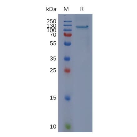 SDS-PAGE - Recombinant Human CD93 Protein (Fc Tag) (A318056) - Antibodies.com
