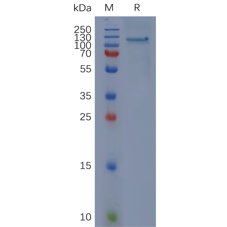 SDS-PAGE - Recombinant Human CD93 Protein (Fc Tag) (A318056) - Antibodies.com