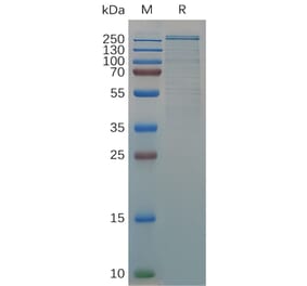 SDS-PAGE - Recombinant Human Von Willebrand Factor Protein (6×His Tag) (A318057) - Antibodies.com