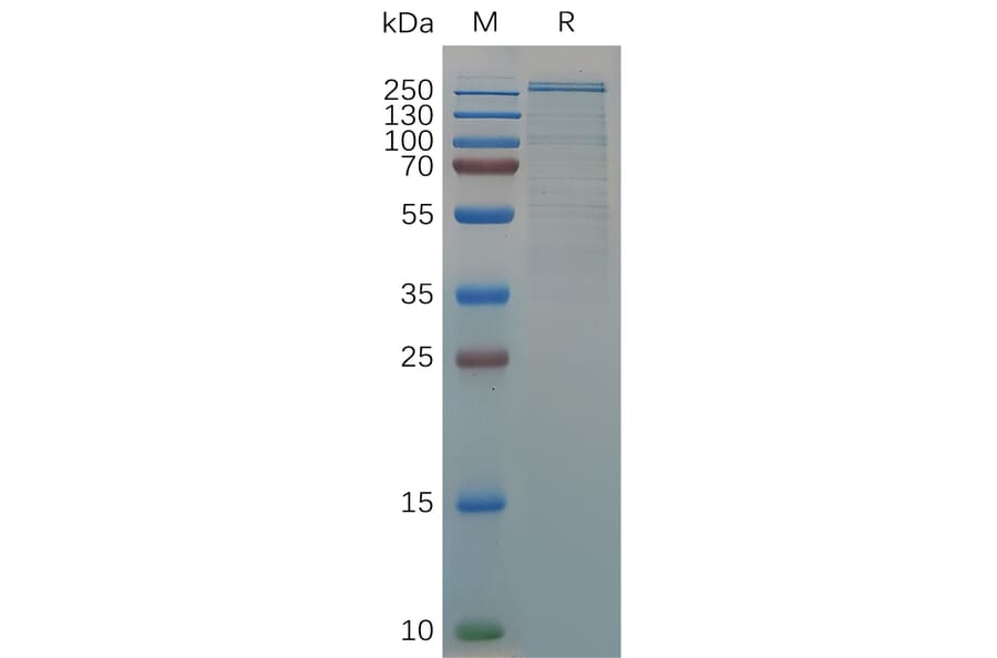SDS-PAGE - Recombinant Human Von Willebrand Factor Protein (6×His Tag) (A318057) - Antibodies.com