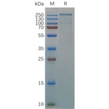 SDS-PAGE - Recombinant Human Von Willebrand Factor Protein (6×His Tag) (A318057) - Antibodies.com