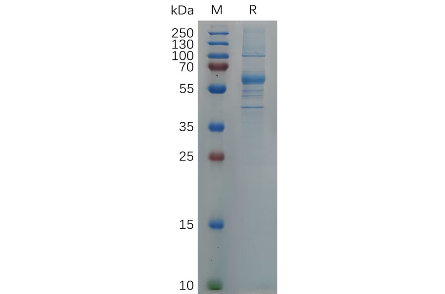 SDS-PAGE - Recombinant SARS-CoV-2 Spike Glycoprotein RBD (Omicron B.1.1.529 Variant) (Fc Tag) (A318058) - Antibodies.com
