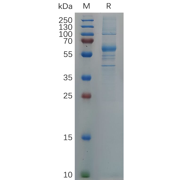 SDS-PAGE - Recombinant SARS-CoV-2 Spike Glycoprotein RBD (Omicron B.1.1.529 Variant) (Fc Tag) (A318058) - Antibodies.com