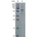 SDS-PAGE - Recombinant SARS-CoV-2 Spike Glycoprotein RBD (Omicron B.1.1.529 Variant) (Fc Tag) (A318058) - Antibodies.com