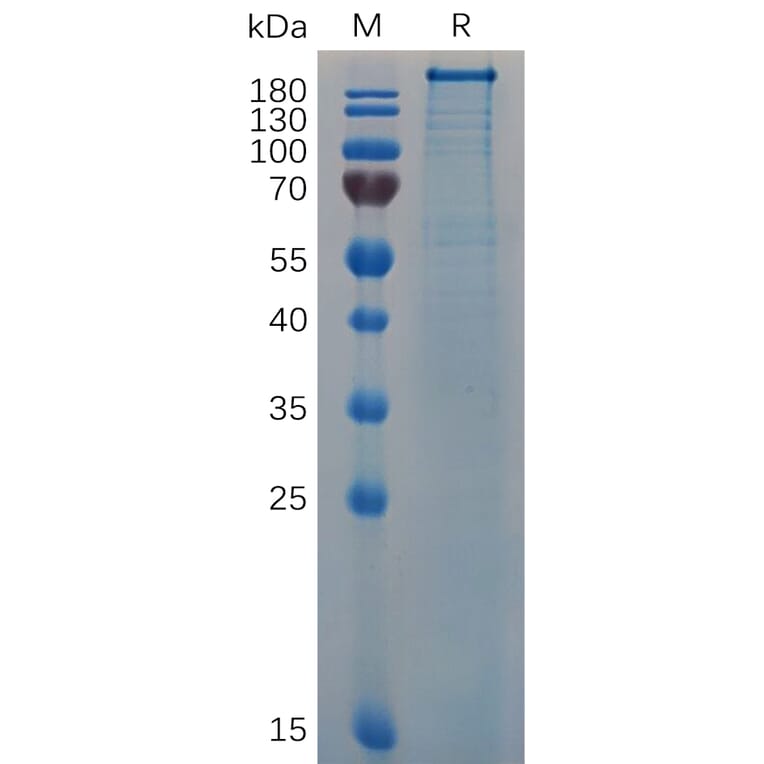 SDS-PAGE - Recombinant Human Von Willebrand Factor Protein (6×His Tag) (A318061) - Antibodies.com