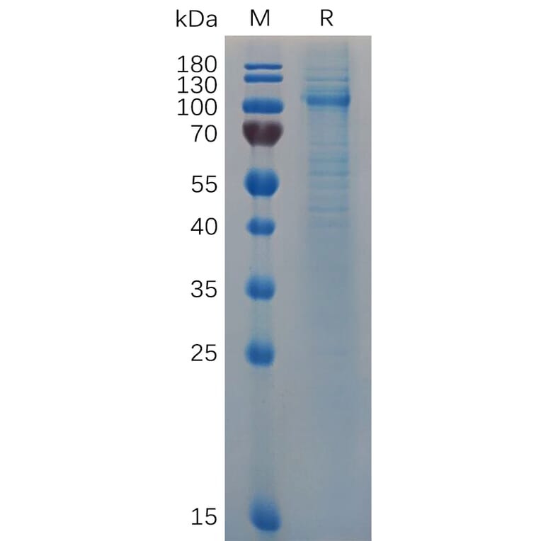 SDS-PAGE - Recombinant Human Von Willebrand Factor Protein (6×His Tag) (A318062) - Antibodies.com