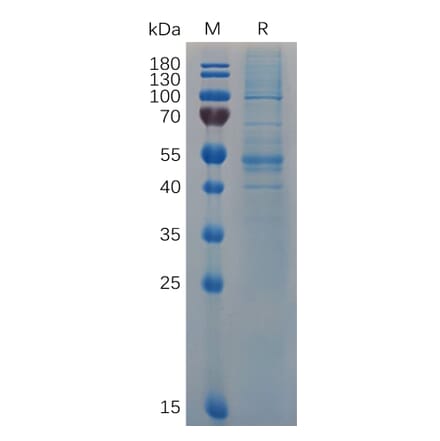 SDS-PAGE - Recombinant Human Interferon beta Protein (Fc Tag) (A318063) - Antibodies.com