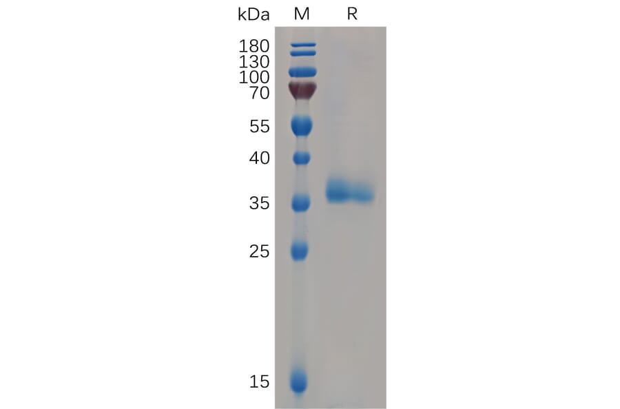 SDS-PAGE - Recombinant Human IGFBP7 Protein (6×His Tag) (A318064) - Antibodies.com
