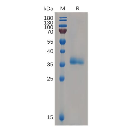 SDS-PAGE - Recombinant Human IGFBP7 Protein (6×His Tag) (A318064) - Antibodies.com