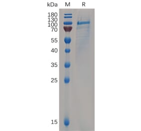 SDS-PAGE - Recombinant Human CD93 Protein (6×His Tag) (A318065) - Antibodies.com