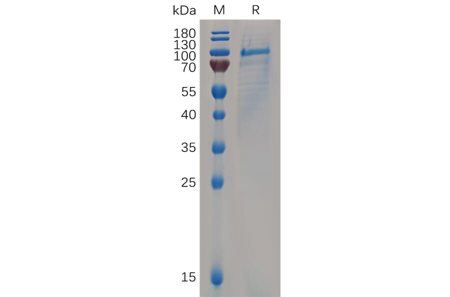SDS-PAGE - Recombinant Human CD93 Protein (6×His Tag) (A318065) - Antibodies.com