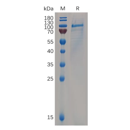 SDS-PAGE - Recombinant Human CD93 Protein (6×His Tag) (A318065) - Antibodies.com