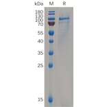 SDS-PAGE - Recombinant Human CD93 Protein (6×His Tag) (A318065) - Antibodies.com