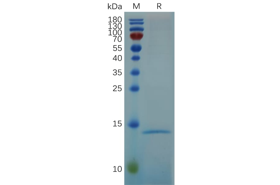 SDS-PAGE - Recombinant Human RNASE4 Protein (6×His Tag) (A318067) - Antibodies.com