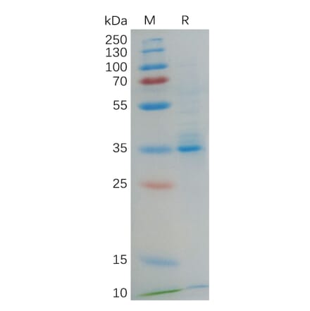 SDS-PAGE - Recombinant Human GPCR GPRC5D Protein (Fc Tag) (A318068) - Antibodies.com