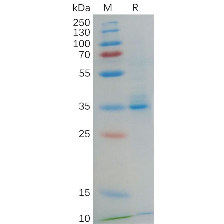 SDS-PAGE - Recombinant Human GPCR GPRC5D Protein (Fc Tag) (A318068) - Antibodies.com