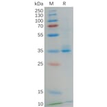 SDS-PAGE - Recombinant Human GPCR GPRC5D Protein (Fc Tag) (A318068) - Antibodies.com