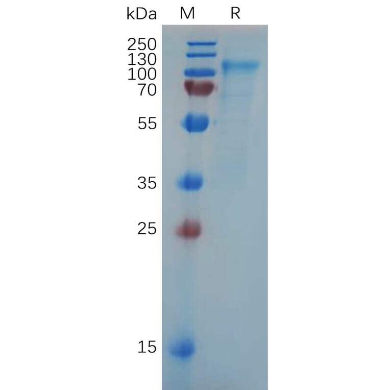 SDS-PAGE - Recombinant Human SLC4A7/NBCn1 Protein (6×His Tag) (A318069) - Antibodies.com
