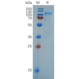 SDS-PAGE - Recombinant Human SLC4A7/NBCn1 Protein (6×His Tag) (A318069) - Antibodies.com