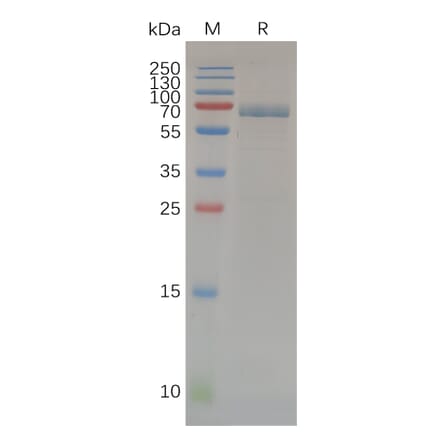 SDS-PAGE - Recombinant Human MMP14 Protein (Fc Tag) (A318070) - Antibodies.com