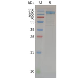 SDS-PAGE - Recombinant Human E Cadherin Protein (Fc Tag) (A318071) - Antibodies.com