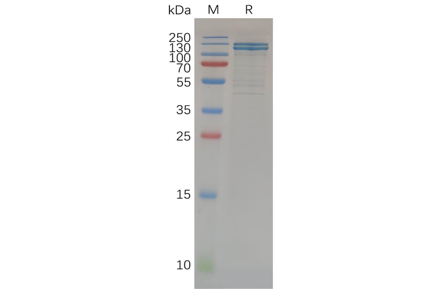 SDS-PAGE - Recombinant Human E Cadherin Protein (Fc Tag) (A318071) - Antibodies.com