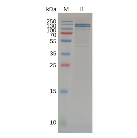 SDS-PAGE - Recombinant Human E Cadherin Protein (Fc Tag) (A318071) - Antibodies.com