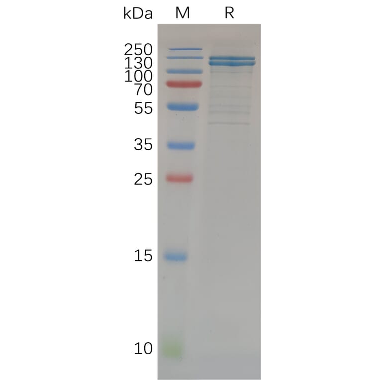 SDS-PAGE - Recombinant Human E Cadherin Protein (Fc Tag) (A318071) - Antibodies.com