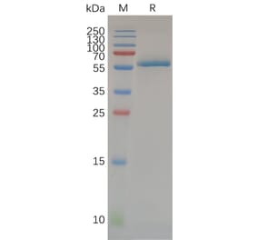 SDS-PAGE - Recombinant Human CD32a Protein (H167 variant) (Fc Tag) (A318072) - Antibodies.com