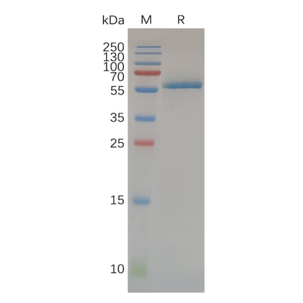 SDS-PAGE - Recombinant Human CD32a Protein (H167 variant) (Fc Tag) (A318072) - Antibodies.com