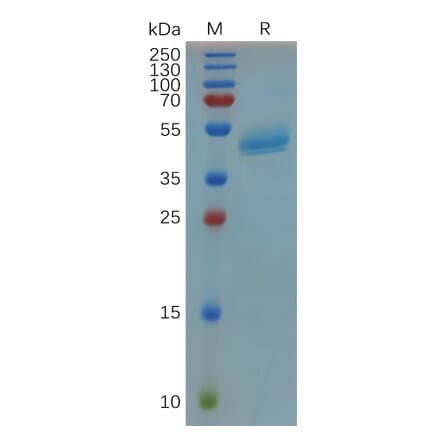 SDS-PAGE - Recombinant Human RSPO3 Protein (Fc Tag) (A318074) - Antibodies.com