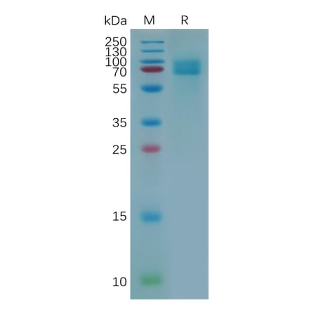 SDS-PAGE - Recombinant Human CD166 Protein (6×His Tag) (A318075) - Antibodies.com