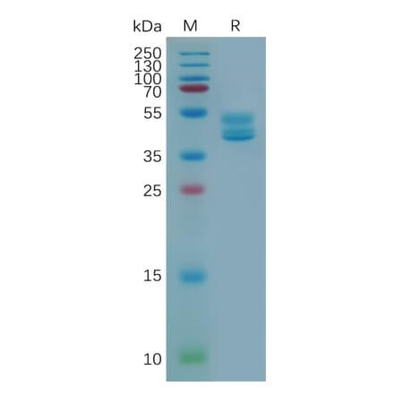 SDS-PAGE - Recombinant Human GPCR C5L2 Protein (Fc Tag) (A318076) - Antibodies.com