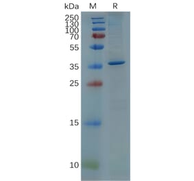 SDS-PAGE - Recombinant Human GFAP Protein (6×His Tag) (A318077) - Antibodies.com