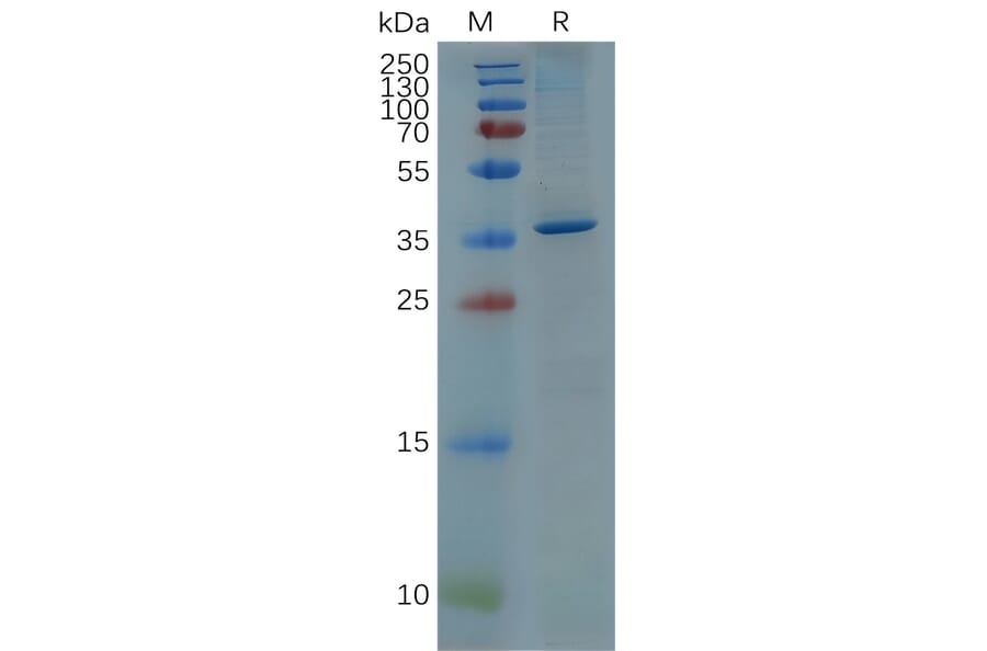 SDS-PAGE - Recombinant Human GFAP Protein (6×His Tag) (A318077) - Antibodies.com