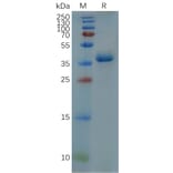 SDS-PAGE - Recombinant Human GFAP Protein (Fc Tag) (A318078) - Antibodies.com