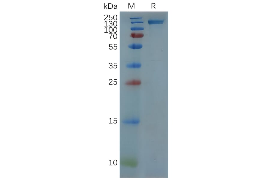 SDS-PAGE - Recombinant Human ErbB2/HER2 Protein (Fc Tag) (A318079) - Antibodies.com