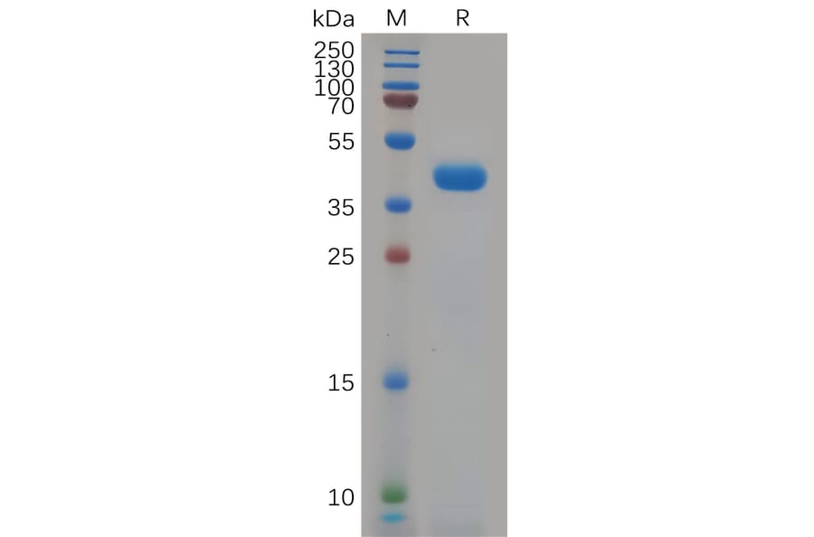 SDS-PAGE - Recombinant Human KCNK9 Protein (Fc Tag) (A318080) - Antibodies.com