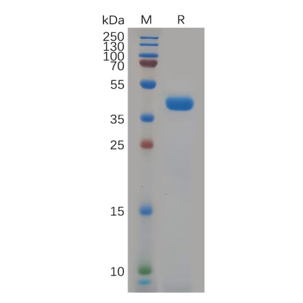 SDS-PAGE - Recombinant Human KCNK9 Protein (Fc Tag) (A318080) - Antibodies.com