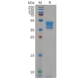 SDS-PAGE - Recombinant Human Glucose Transporter GLUT4 Protein (Fc Tag) (A318081) - Antibodies.com