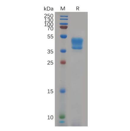 SDS-PAGE - Recombinant Human Glucose Transporter GLUT4 Protein (Fc Tag) (A318081) - Antibodies.com