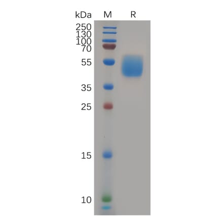 SDS-PAGE - Recombinant Human GPCR GPR87 Protein (Fc Tag) (A318082) - Antibodies.com