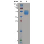SDS-PAGE - Recombinant Human GPCR GPR87 Protein (Fc Tag) (A318082) - Antibodies.com