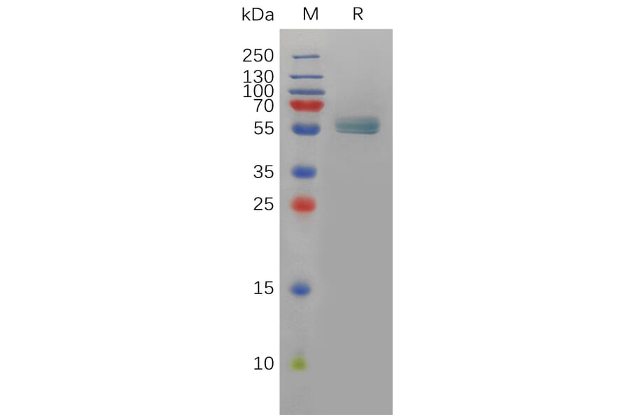 SDS-PAGE - Recombinant Human EDA Protein (Fc Tag) (A318083) - Antibodies.com
