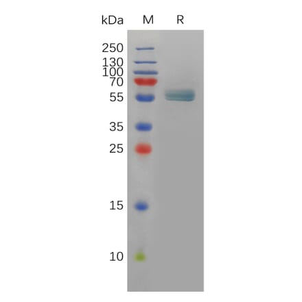 SDS-PAGE - Recombinant Human EDA Protein (Fc Tag) (A318083) - Antibodies.com