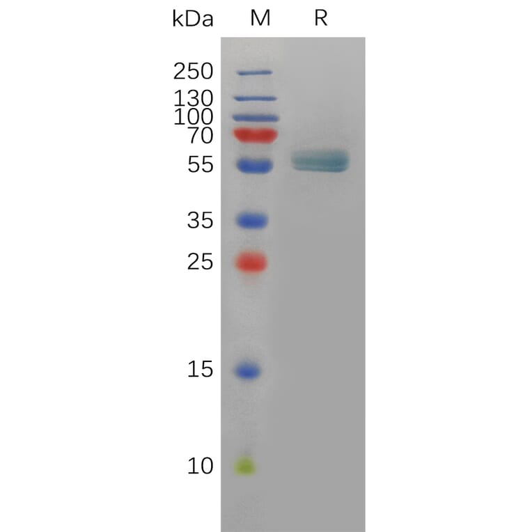 SDS-PAGE - Recombinant Human EDA Protein (Fc Tag) (A318083) - Antibodies.com