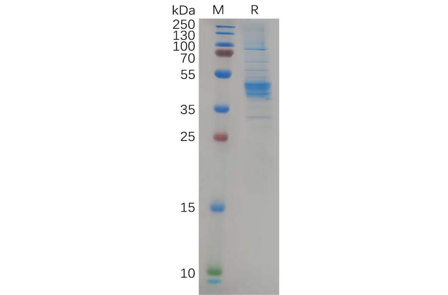 SDS-PAGE - Recombinant Human CCR6 Protein (Fc Tag) (A318084) - Antibodies.com