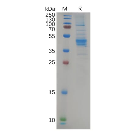 SDS-PAGE - Recombinant Human CCR6 Protein (Fc Tag) (A318084) - Antibodies.com